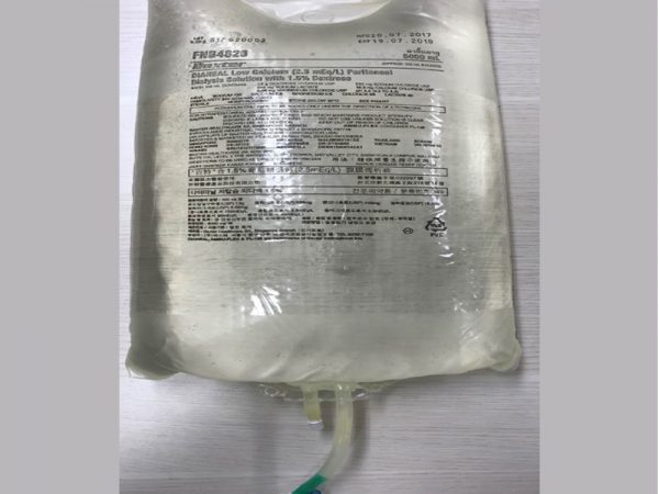 Dung dịch thẩm phân phúc mạc chứa 2,5 mEq/L Canxi với 1,5% Dextrose